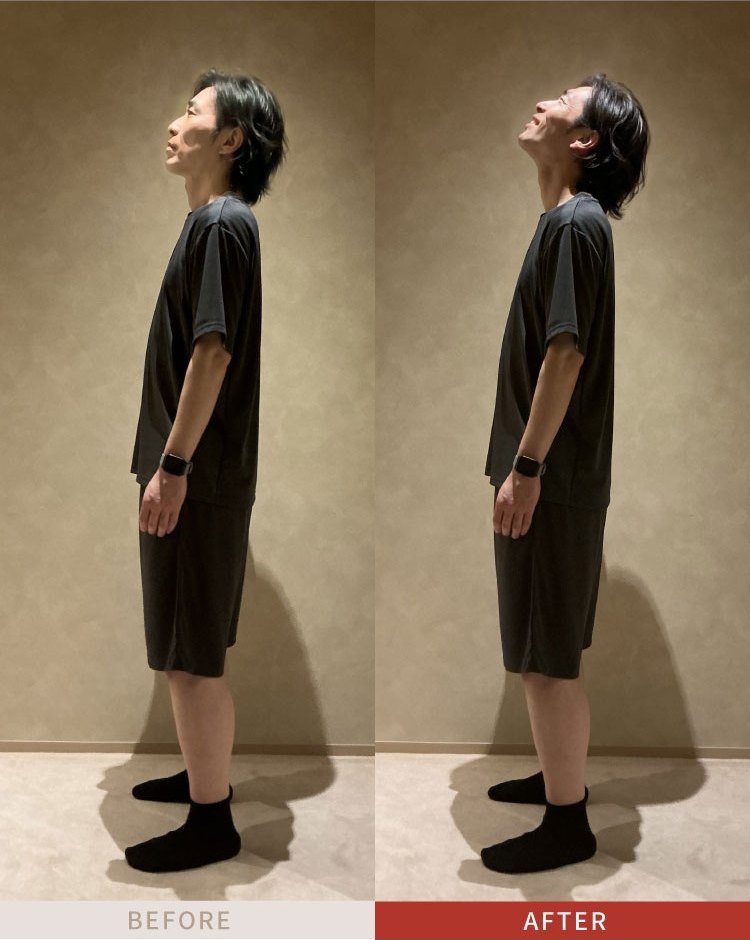 施術例2のビフォーアフター